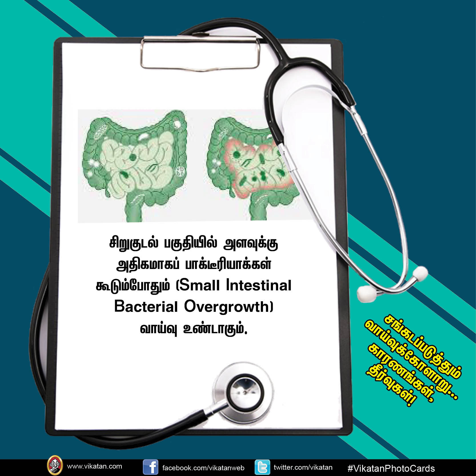 சங்கடப்படுத்தும் வாய்வுக்கோளாறு... காரணங்கள், தீர்வுகள்! #VikatanPhotoCards சங்கடப்படுத்தும் வாய்வுக்கோளாறு... காரணங்கள், தீர்வுகள்! #VikatanPhotoCards