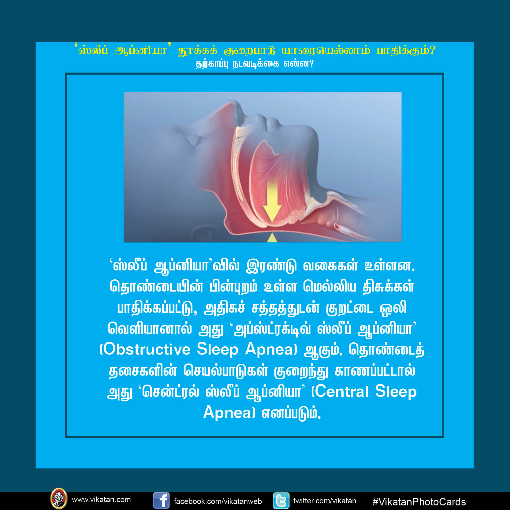 'ஸ்லீப் ஆப்னியா' தூக்க குறைபாடு யாரையெல்லாம் பாதிக்கும்? #VikatanPhotoCards 'ஸ்லீப் ஆப்னியா' தூக்க குறைபாடு யாரையெல்லாம் பாதிக்கும்? #VikatanPhotoCards