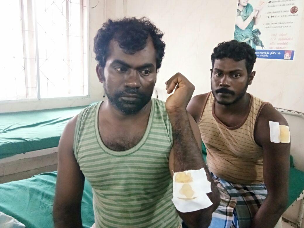 இந்திய கடற்படையினரின் தாக்குதலில் காயமடைந்த மீனவர்கள்