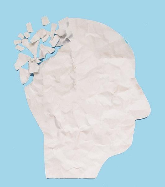 அல்சைமர்