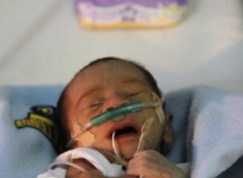 குழந்தைகள் சிகிச்சை