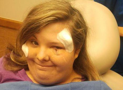 வெயில் பட்டால் வெந்துவிடும் தோல் - லிஸி