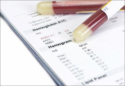 HbA1c